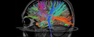 Brain image, sagittal DTI
