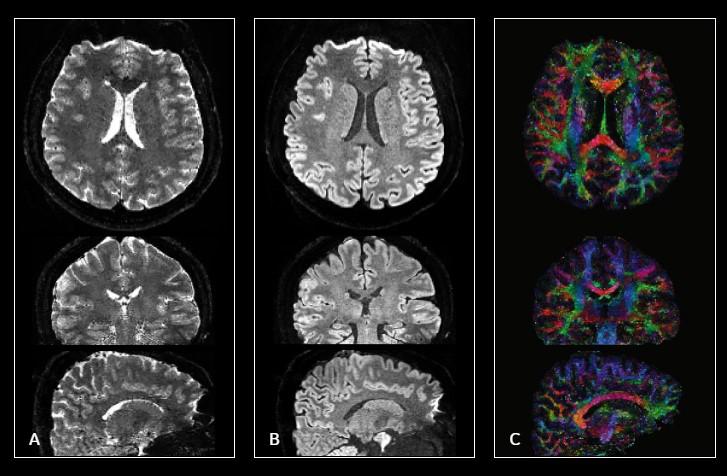 MUSE brain images