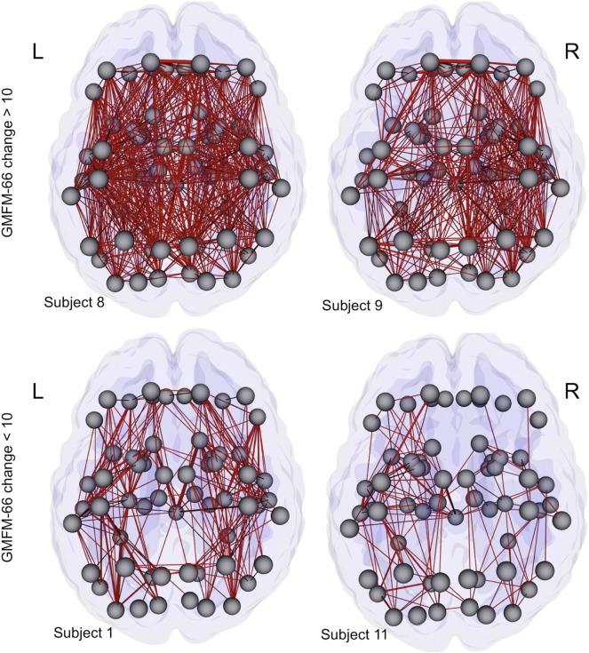 The distribution of connectivity increases over a 2-year period throughout the whole brain for four representative subjects