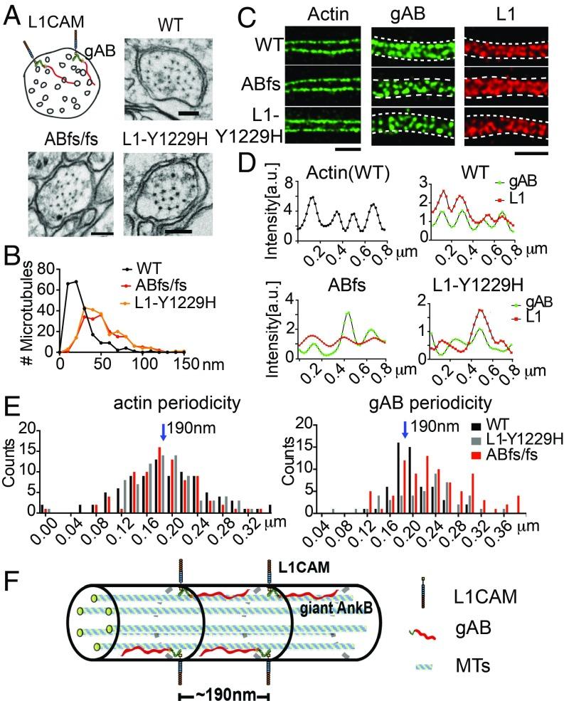 Giant ankB colocalizes with L1CAM