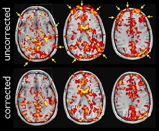 Uncorrected and corrected brain activation maps