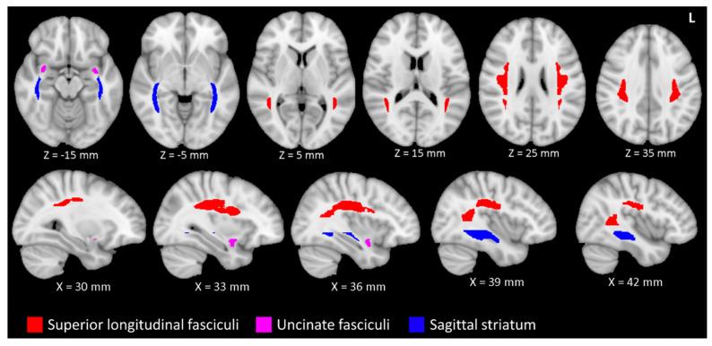 Brain regions related to musical proficiency and age