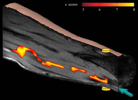 Neuroelectric Activity In Vivo