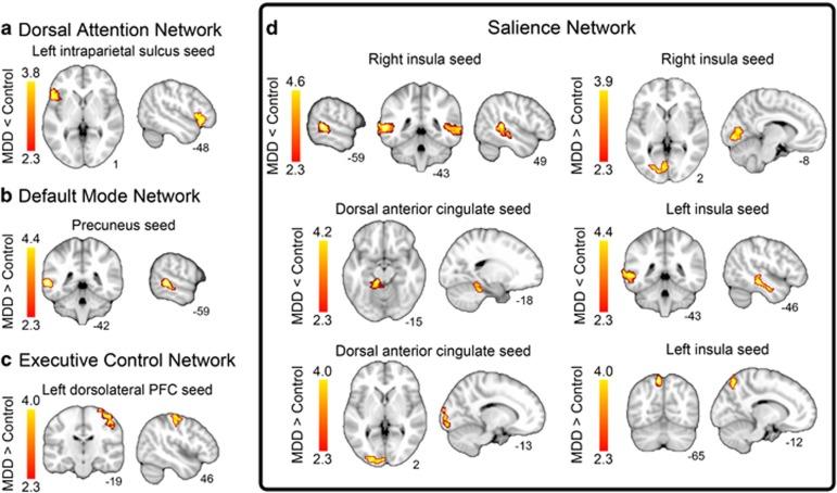 Group differences in resting-state connectivity