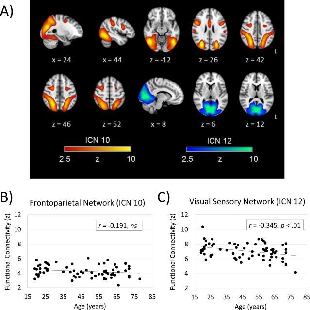 Resting‐state networks