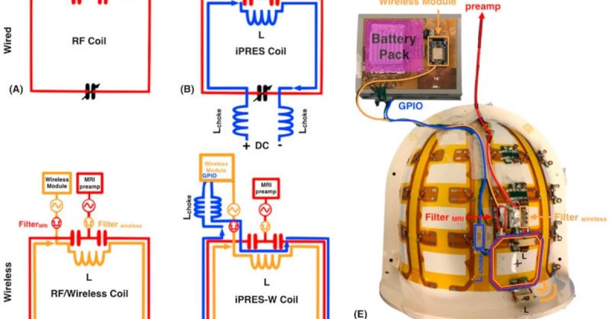 Integrated radio-frequency/wireless coil design for simultaneous MR